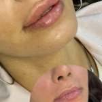 تصویر کلینیک لیزر و زیبایی دالیا