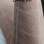 کلینیک لیزر الکس و زیبایی آنجل