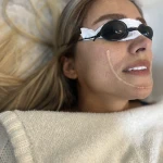 تصویر لیزر موهایی زائد بیوتینا