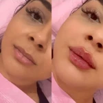 نمونه کار کلینیک تخصصی پوست،مو،زیبایی،لیزر لاولی