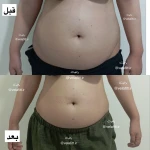 کلینیک تخصصی لاغری موضعی ولافیت