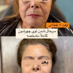 کلینیک لیزر وکلینیک زیبایی پایون(بانوان)