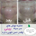 مرکز لیزر و فیشال دکتر خالقیان