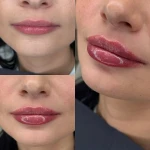 کلینیک لیزر , زیبایی و لاغری نوران
