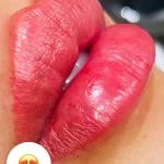 نمونه کار مرکز لیزر و فیلر وجوانسازی وزیبایی شاینا