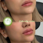 تصویر کلینیک زیبایی‌ سلین اسکین سنتر