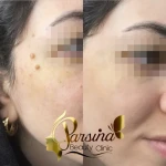 کلینیک زیبایی پارسینا