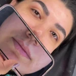 نمونه کار مرکز لیزر و زیبایی نویامِد