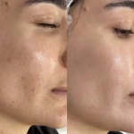 تصویر خدمات تخصصی پوست سالن هانی