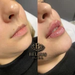 نمونه کار کلینیک زیبایی بلژو