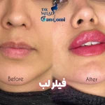کلینیک زیبایی و لیزر دکتر میلاد گندمی