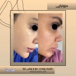 کلینیک زیبایی و لیزر لیزا