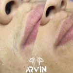 کلینیک زیبایی آروین