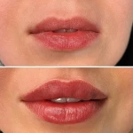 کلینیک زیبایی ریجینا
