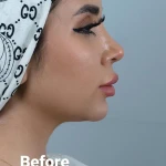  مرکز لیزر و کلینیک زیبایی تجریش