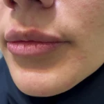 کلینیک پوست و زیبایی دکتر زریان جعفری