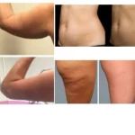 نمونه کار بهترین کلینیک زیبایی فلاح هایفو سودا