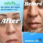 کلینیک پوست مو زیبایی و لیزر آدونیس