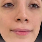 کلینیک لیزر و پوست و مو و زیبایی آرشینو