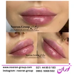 کلینیک لیزر , زیبایی و لاغری نوران