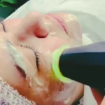  پاکسازی پوست و فیشال تخصصی و درمانی الا