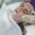 پاکسازی پوست آزیتا (هدیه مراجعه اول🎁)