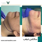  کلینیک پوست ، مو و لیزر نارینا