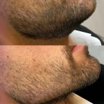 کلینیک زیبایی و لیزر رولا