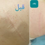 تصویر مرکز لیزرو کلینیک زیبایی طراوت